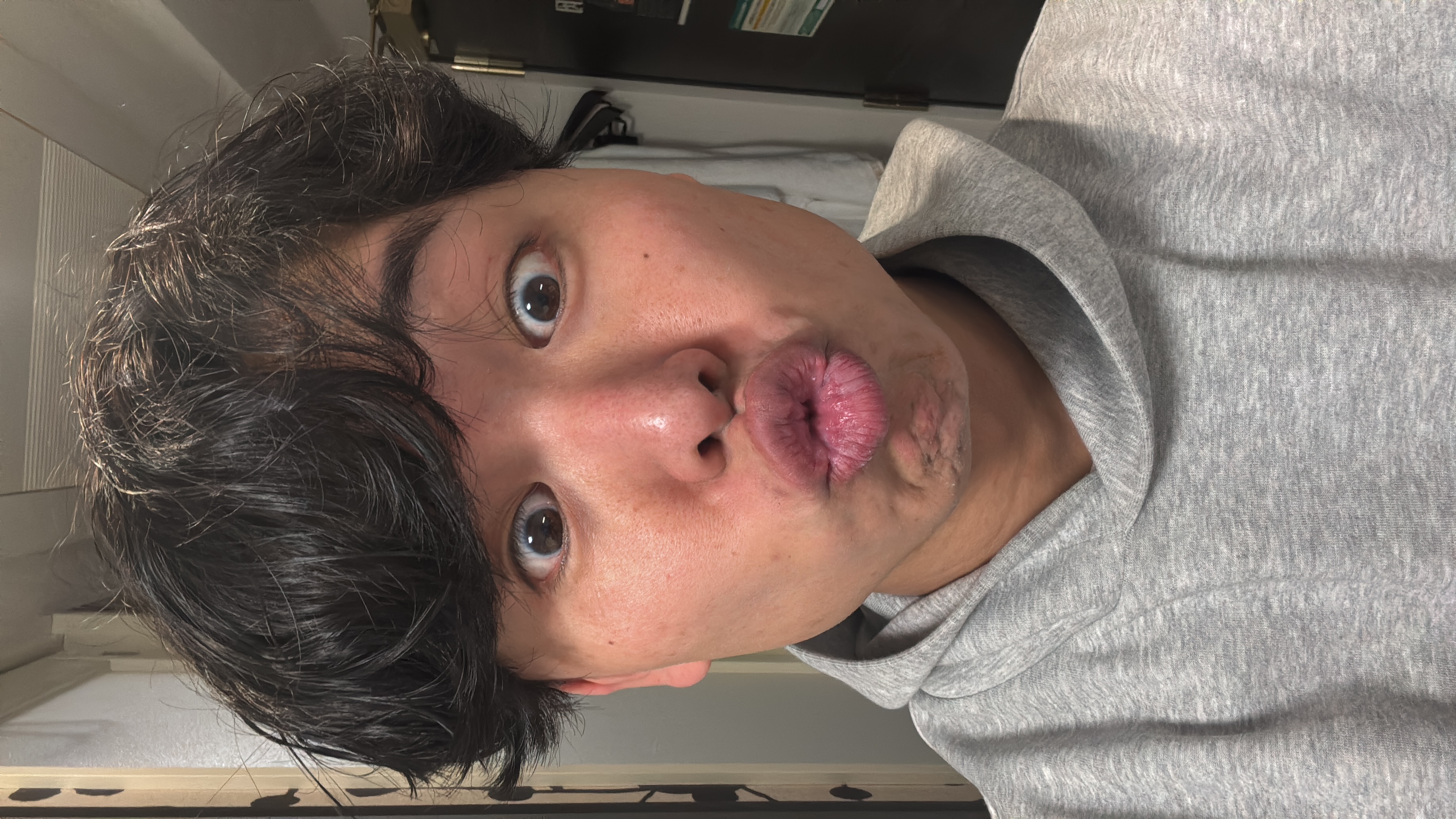 Ryo